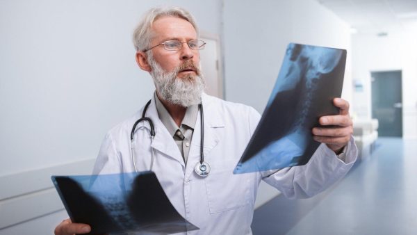 Bearded doctor in a white coat holds up two X-ray films, examining scans in a hospital hallway.